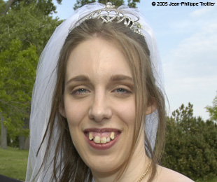 Marie-Hélène Cyr - Before orthodontic treatments and orthognathic surgeries (June 4, 2005)